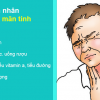 Nguyên nhân của bệnh đau họng là gì ?