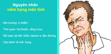Nguyên nhân của bệnh đau họng là gì ?