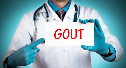 điều trị gout
